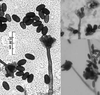 toxic black mould spores 1